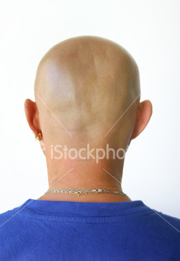 stock-photo-578354-baldness.jpg