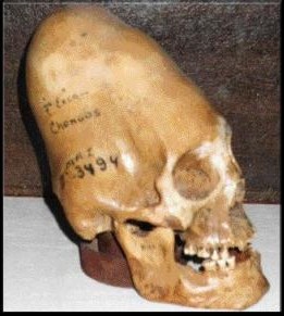 skull_ica.jpg